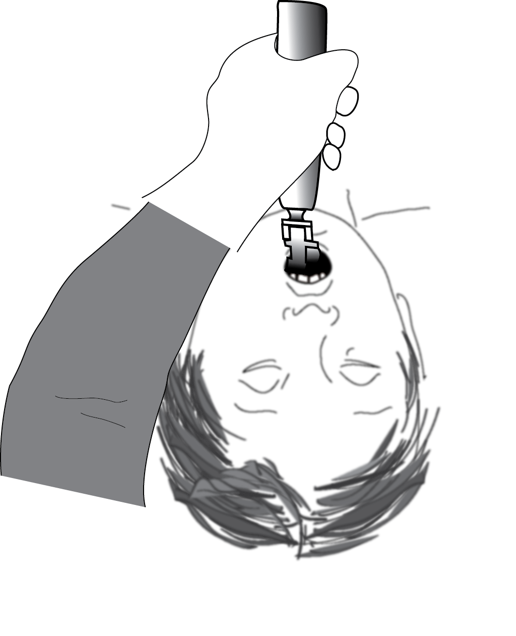 Learning Intubation A Beginners Guide The Airway Jedi